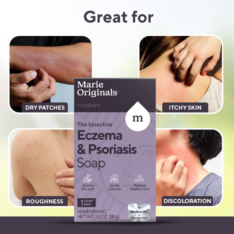 Eczema / Psoriasis SoapSkin Caremarieoriginals.com