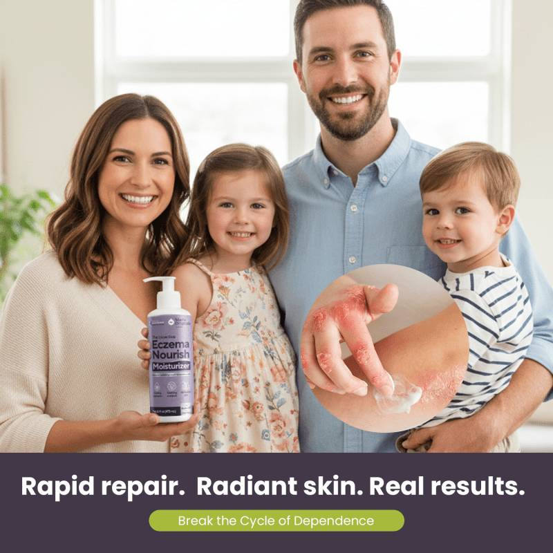 Marie Originals Eczema Nourish Moisturizing LotionMarie Originals